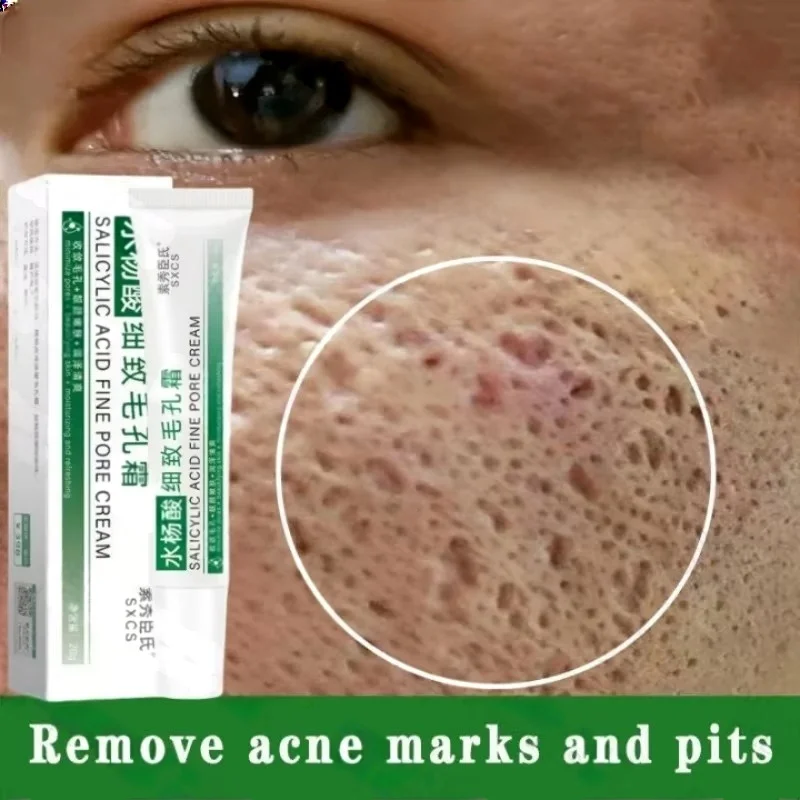 Korean Skincare Routine - Salicylsäure Poren Clearing Creme Schrumpfen Poren