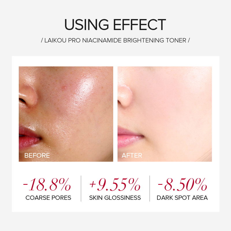 LAIKOU PRO Niacinamid 4-teilig – Korean Skincare Routine Bewertung und Preis