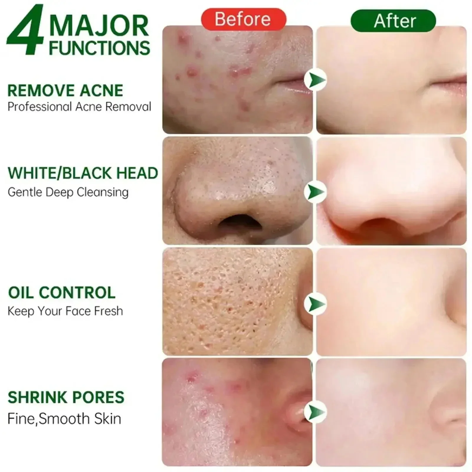 Salicylsäure Poren Clearing Cr – Korean Skincare Routine Bewertung und Preis