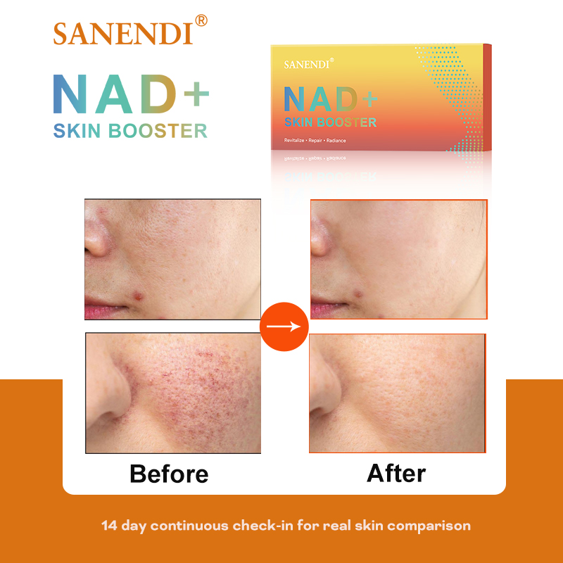 Sanendi NAD+ Korea Hautpflegep – Korean Skincare Routine Bewertung und Preis