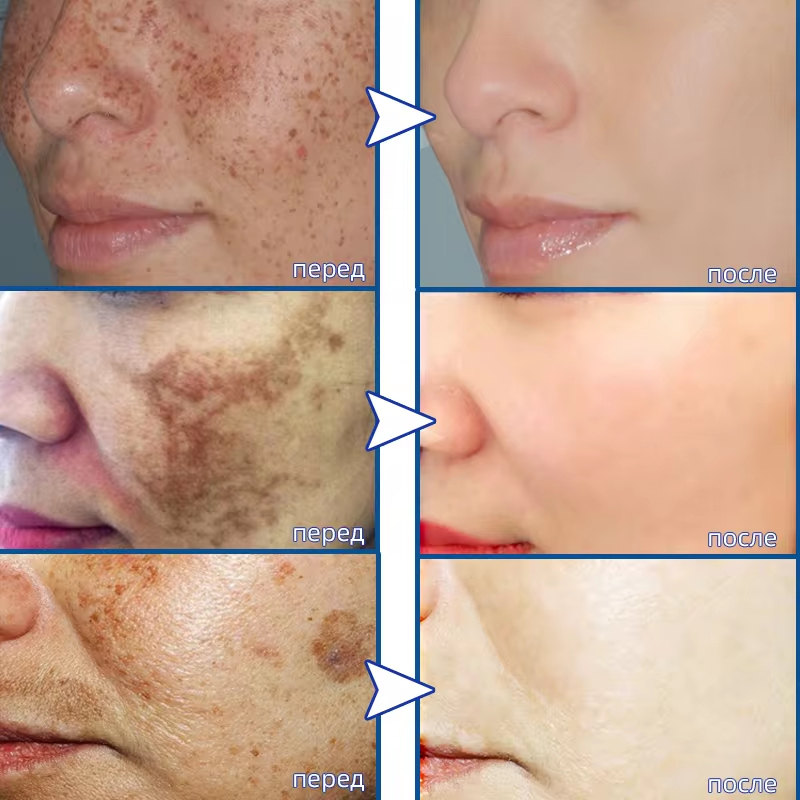 Leistungsstarke Whitening-Crem – Korean Skincare Routine Bewertung und Preis