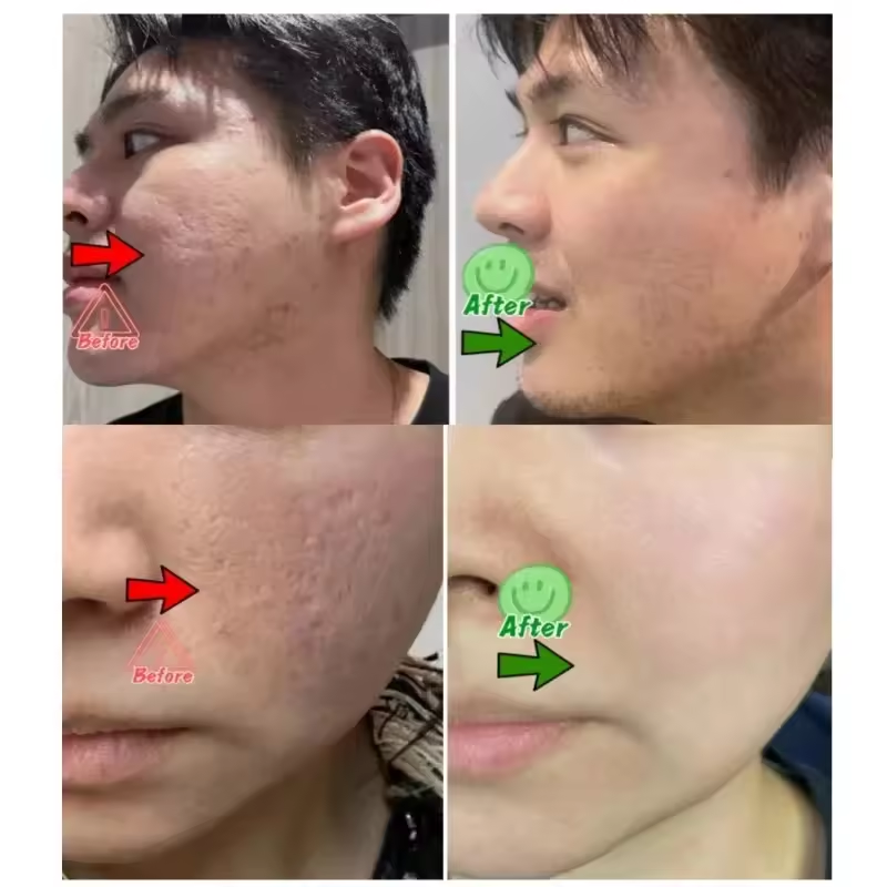 Porenschrumpfende Creme Elimin – Korean Skincare Routine Bewertung und Preis